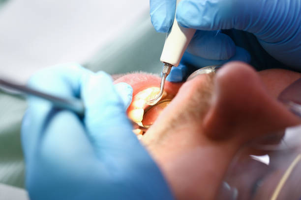 Best Emergency Gum Treatment in Swansboro, NC